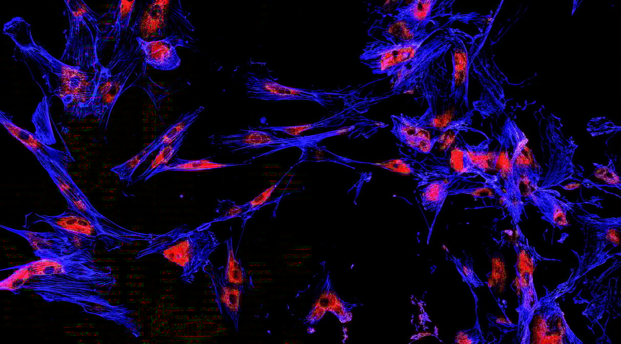 Multiplexage quantitatif-Immunofluorescence
